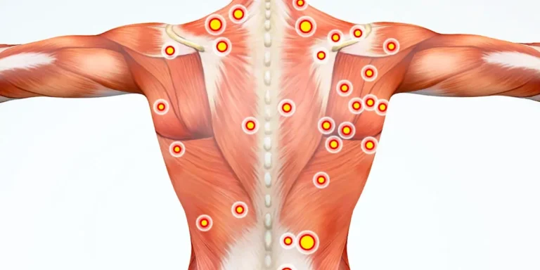 back pain