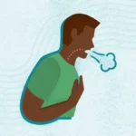 Chronic Dry Cough